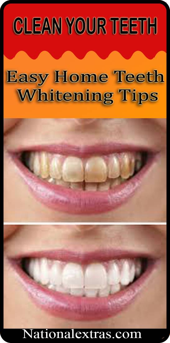 Easy Home Teeth Whitening Tips